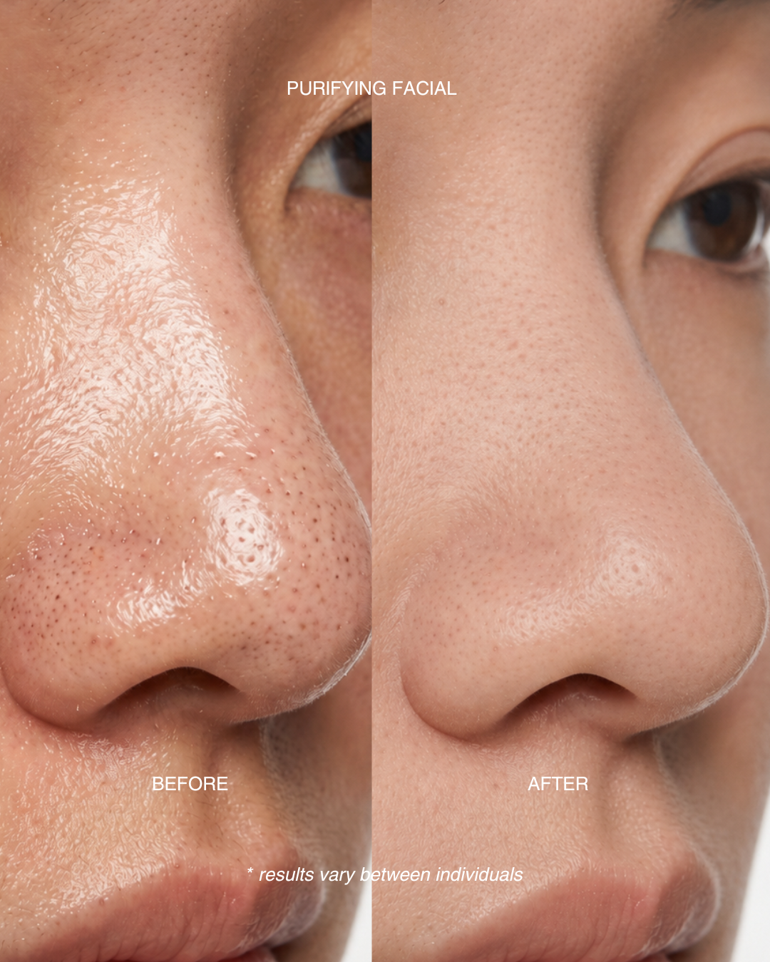 Purifying Facial