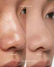 Purifying Facial
