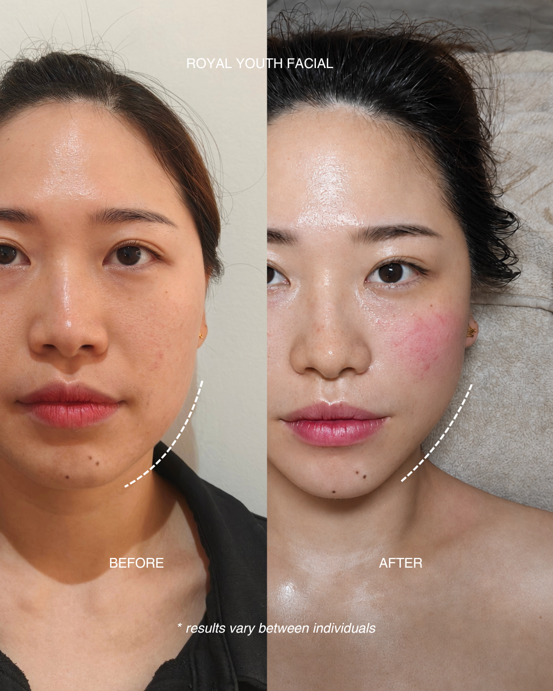 Royal Youth Facial