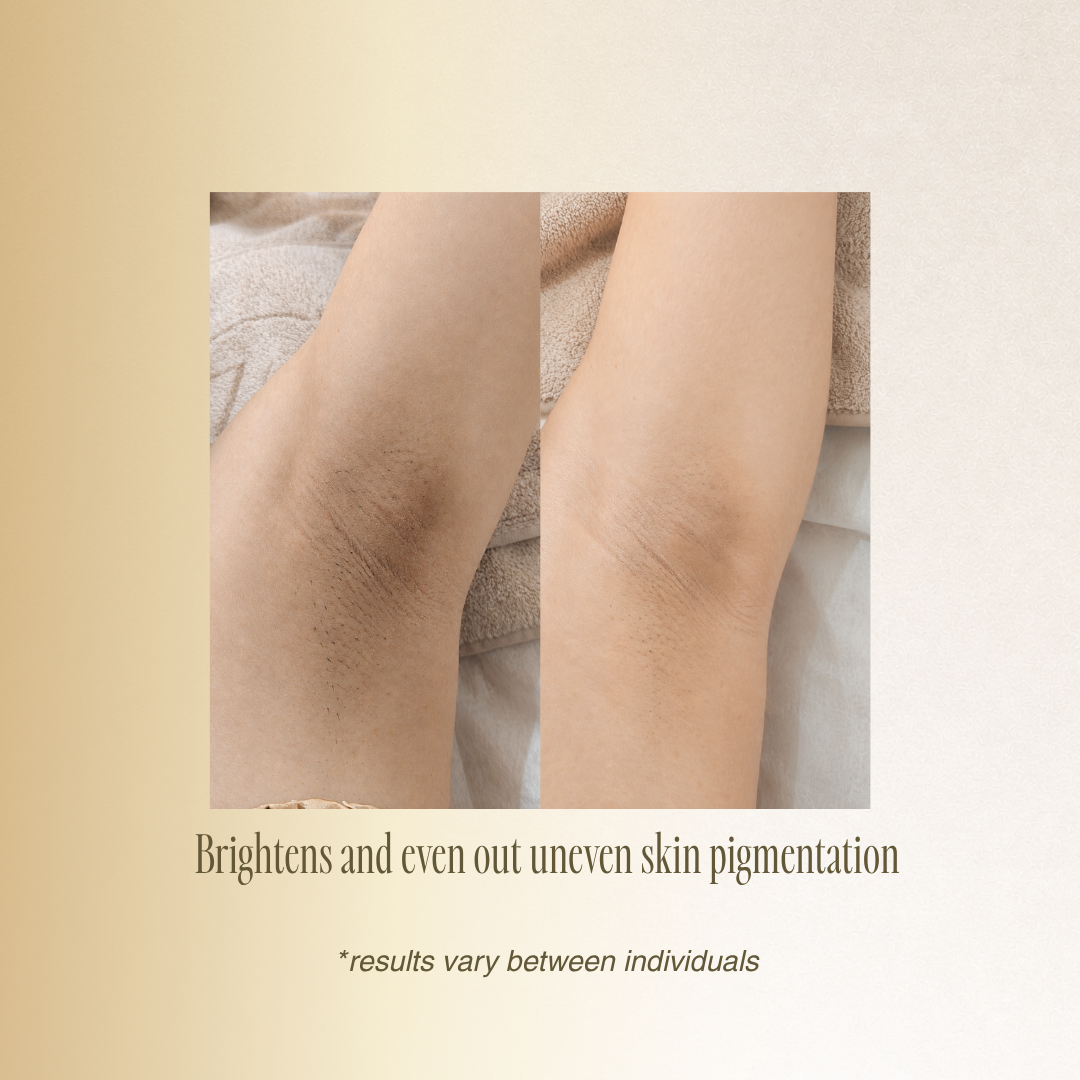 OPT Hair Removal (Small Area)