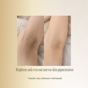 OPT Hair Removal (Small Area)
