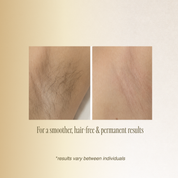 OPT Hair Removal (Small Area)
